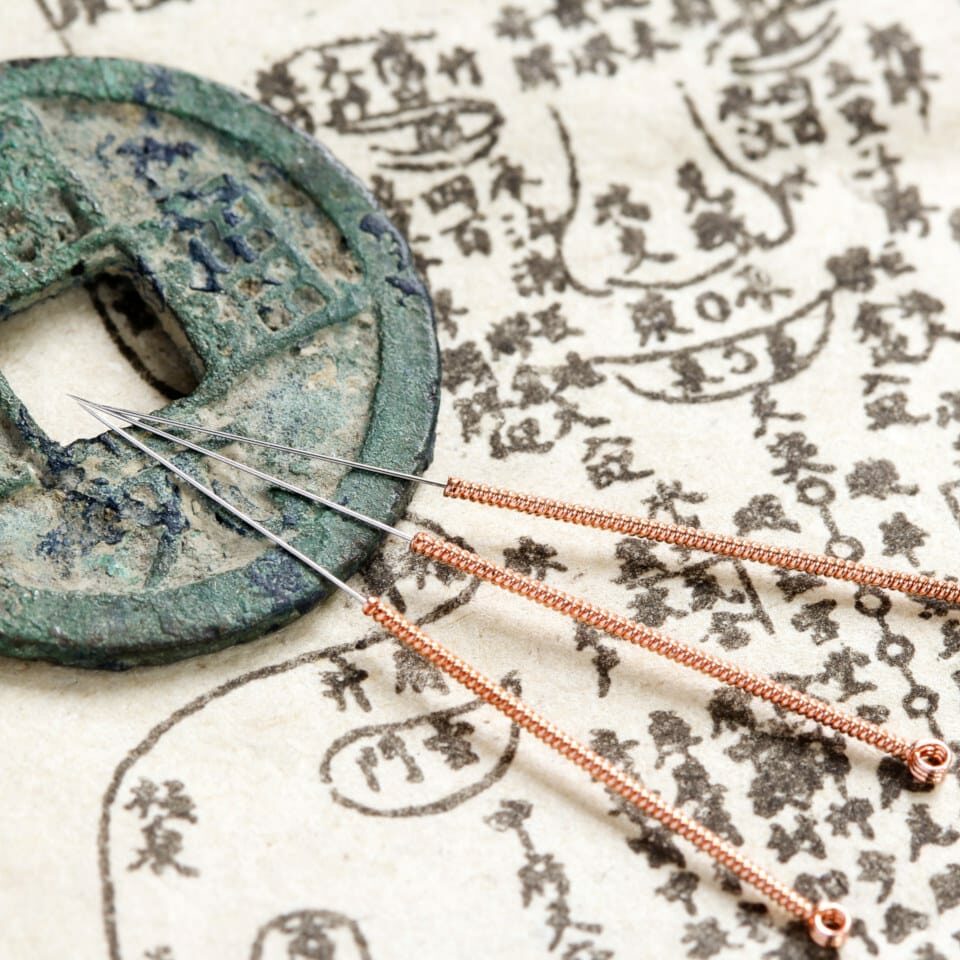 Acupuncture